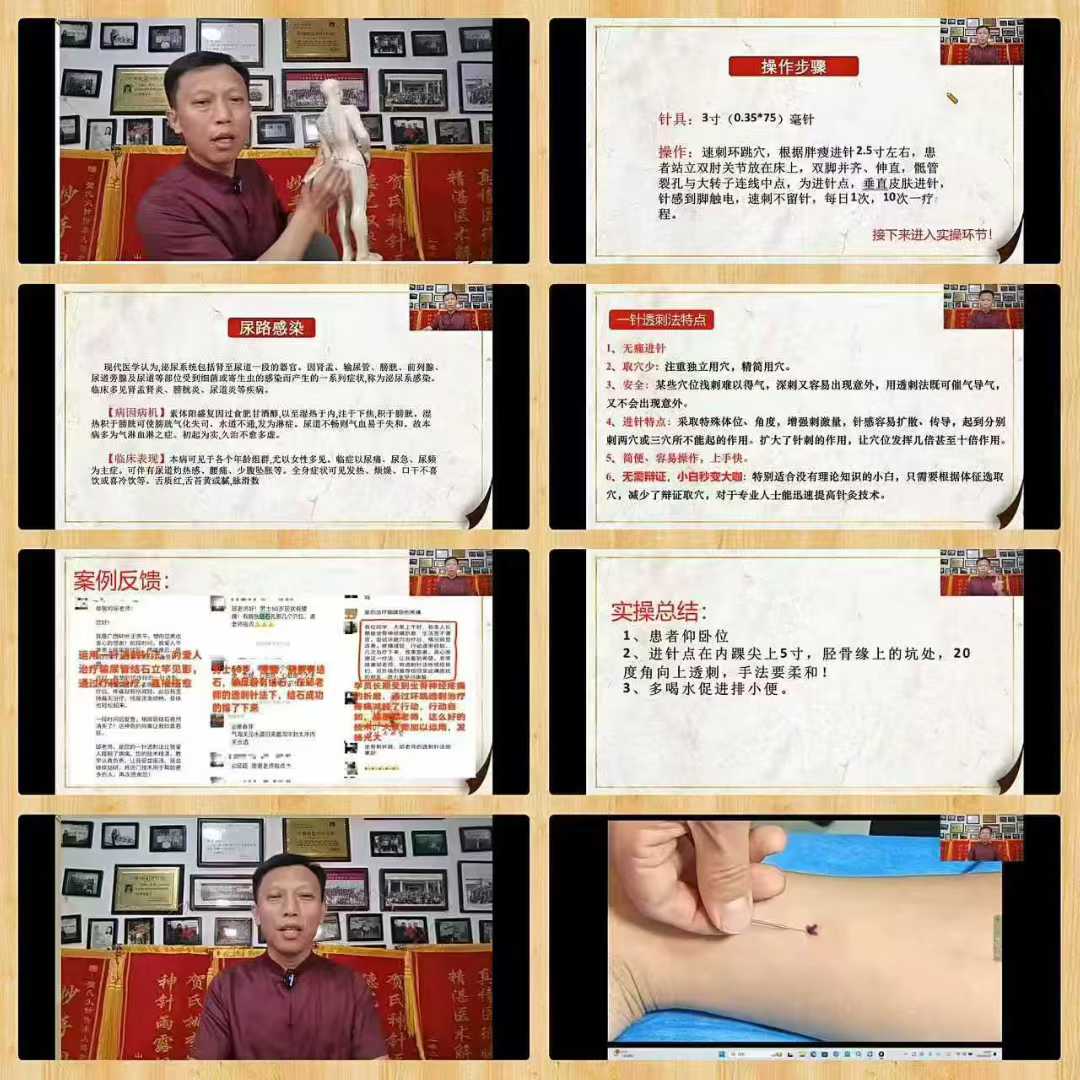 道医神针 3天课
